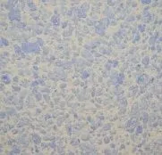 жидкие Silk Plaster Рельеф Г-326